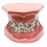 ORB2 modello ortodontico bracket - Gestor Cosmetics